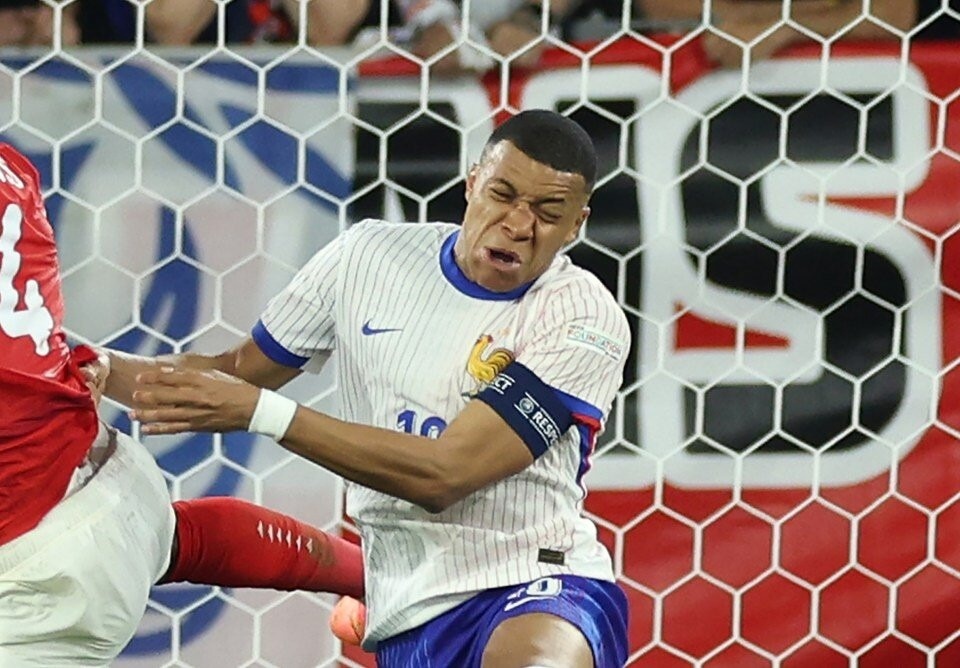 Ôi trời Mbappe gãy mũi mất rồi